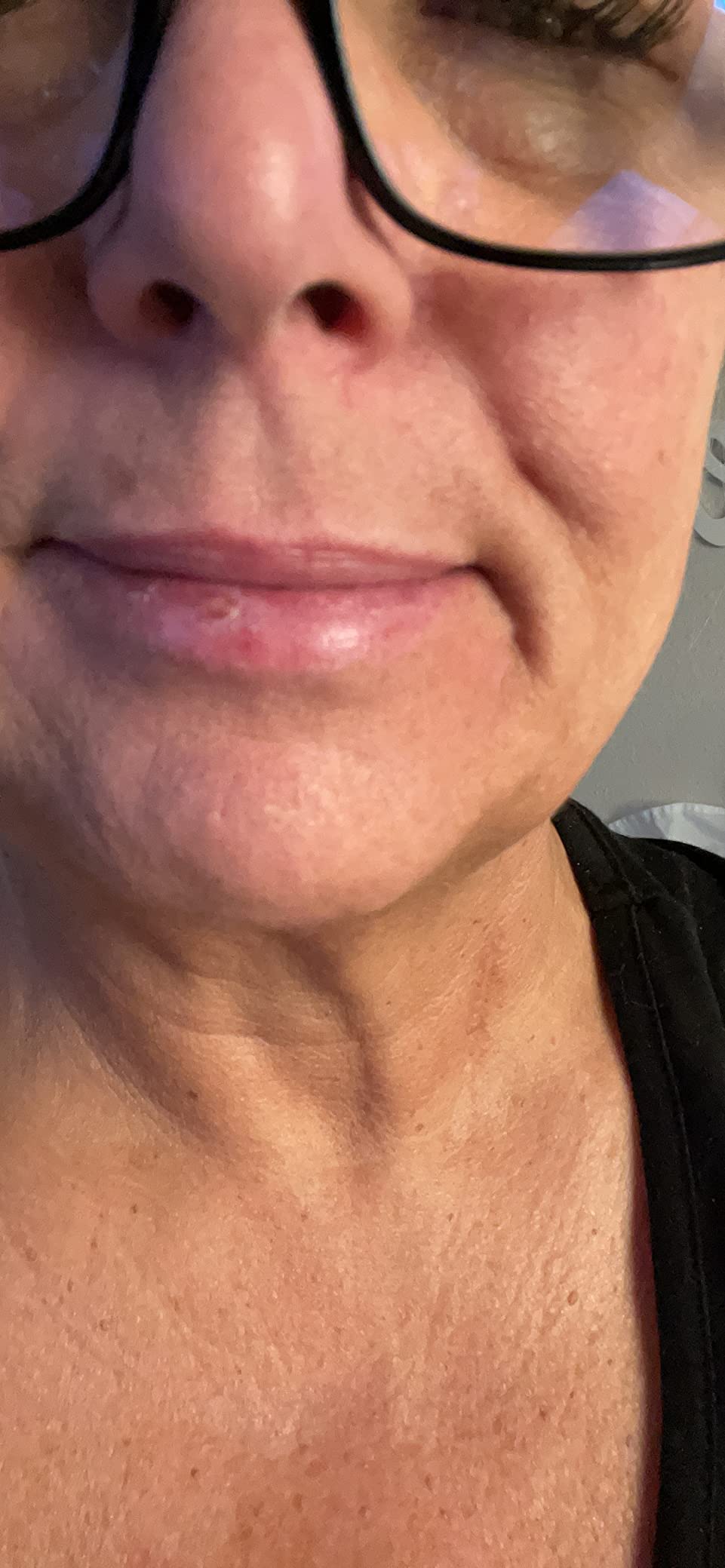EltaMD UV Lip Balm Sunscreen, Moisturizes and Protects Dry Cracked Lips, Water Resistant up to 80 Minutes, Transparent Zinc Oxide Sunscreen customer photo 1