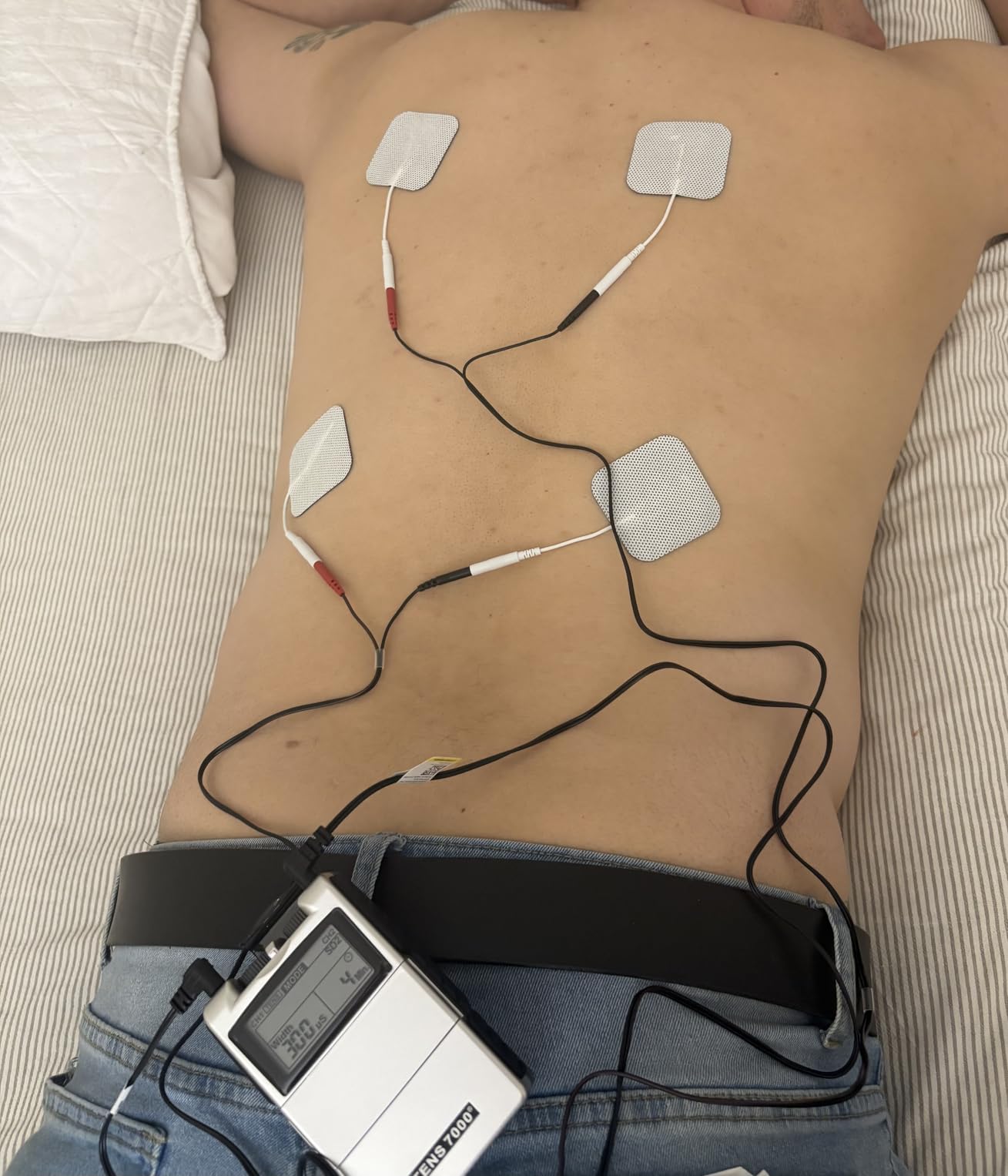 TENS 7000 Digital TENS Unit with Accessories - Muscle Stimulator Machine for Back Pain Relief, Sciatica, Neck, Nerve, Shoulder, Hip, Elbow, Muscle Pain Relief customer photo 2