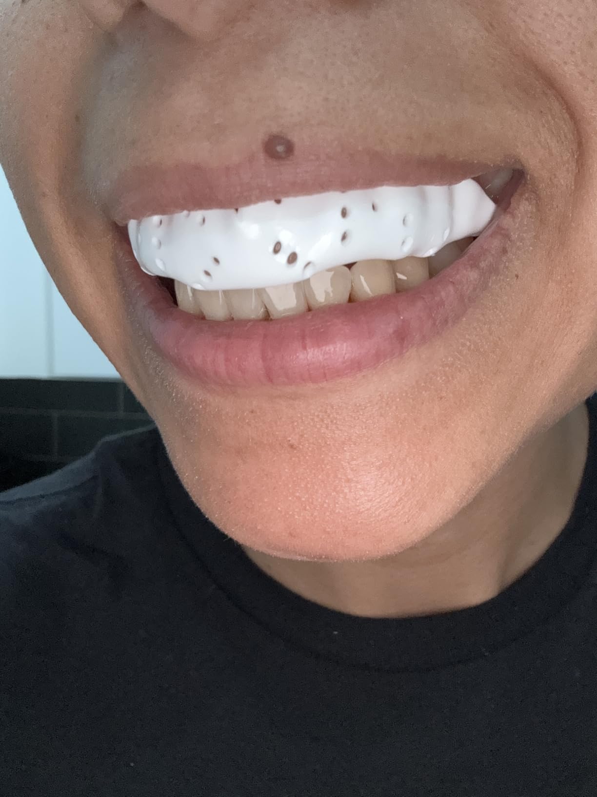 SISU Aero Medium Mouthguard, Charcoal Black - 30% Stronger Protection for Lacrosse, Football, Hockey, Roller Derby, Team Sports - Remoldable Up to 20 Times - Ultra Slim - Works for Braces - Non Toxic customer photo 2