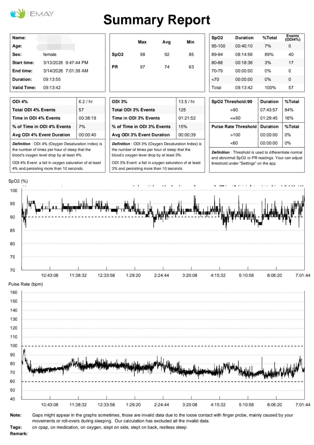 EMAY SleepO2 Wrist Recording Pulse Oximeter | Continuous Pulse Oximeter to Record Blood Oxygen Saturation and Pulse Rate Overnight | Export Sleep Report & Raw Data customer photo 1