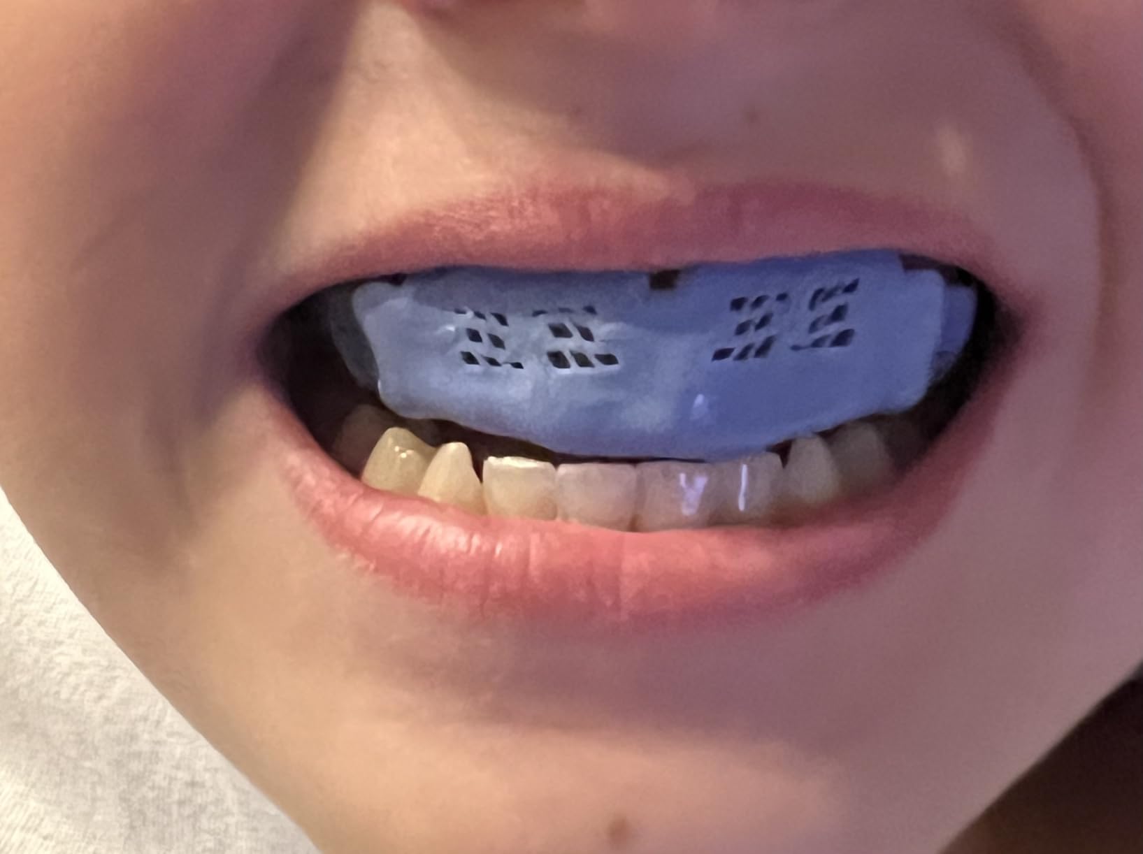 Bulletproof: World's Thinnest Most Breathable Mouthguard is 3X Stronger! BJJ Lacrosse Football Basketball MMA Wrestling Hockey Rugby Boxing Men Sports Mouth Guard Grinding Teeth Adult Youth Braces customer photo 2