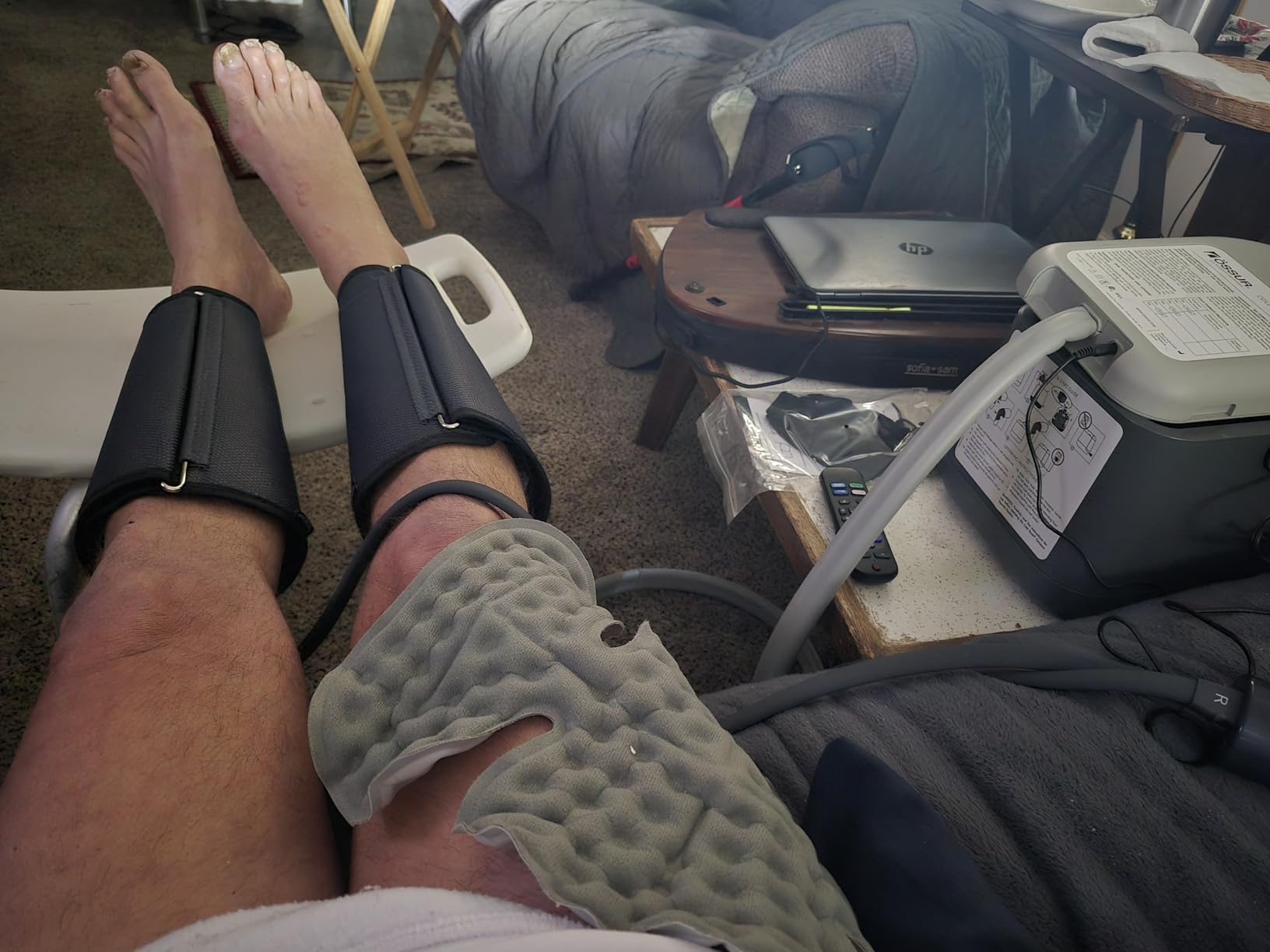 Cold Rush Compact Therapy Ice Machine - Cryotherapy System for Pain Relief & Cold Compression - Post-Surgery & Injury Recovery - with Replacement Cryo Cuff Pads (Device Only) customer photo 1