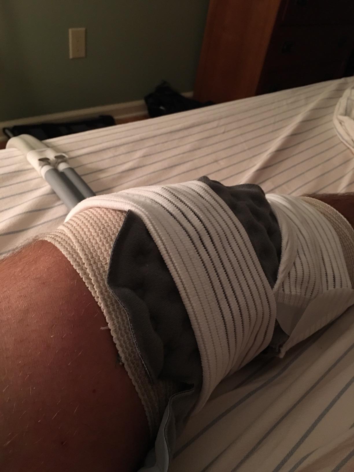 Cold Rush Compact Therapy Ice Machine - Cryotherapy System for Pain Relief & Cold Compression - Post-Surgery & Injury Recovery - with Replacement Cryo Cuff Pads (Device Only) customer photo 2