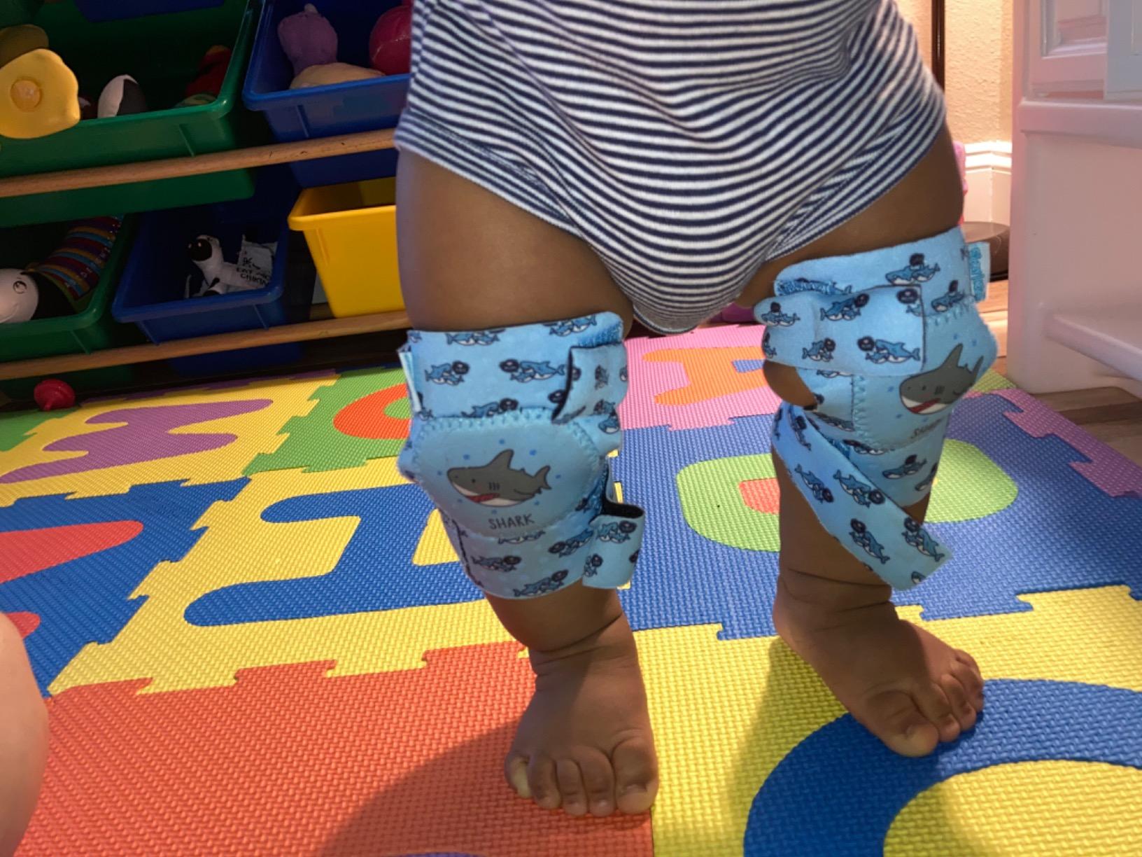 Simply Kids Baby Knee Pads for Crawling (2 Pairs) Rodilleras para Bebe, CPSIA Certified - Infant Knee Protector for Toddler, Girl, Boy, Crawler customer photo 1