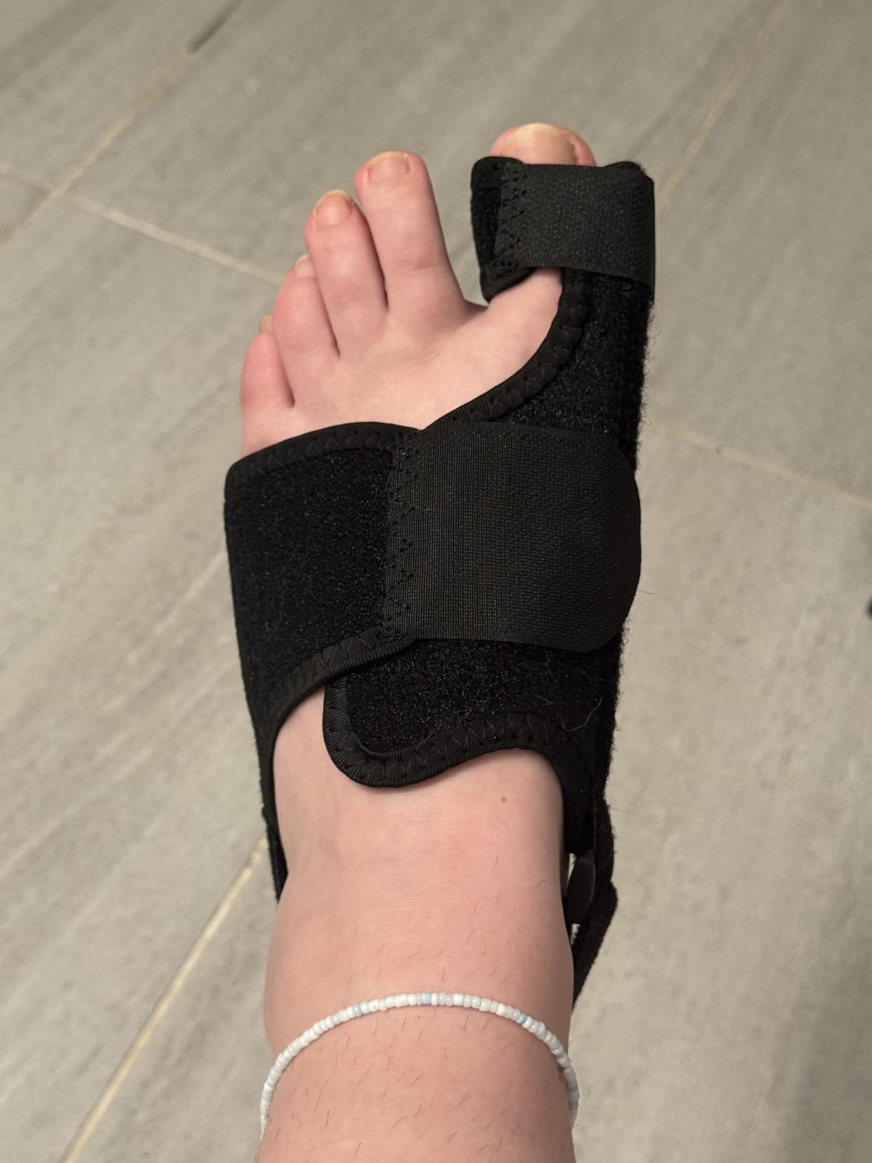 MOONSMILE 1 Pair Foot Bunion Corrector for Women & Men, Night Bunion Splint, Big Toe Straightener, Foot Gear Bunion Brace for Pain Relief customer photo 2