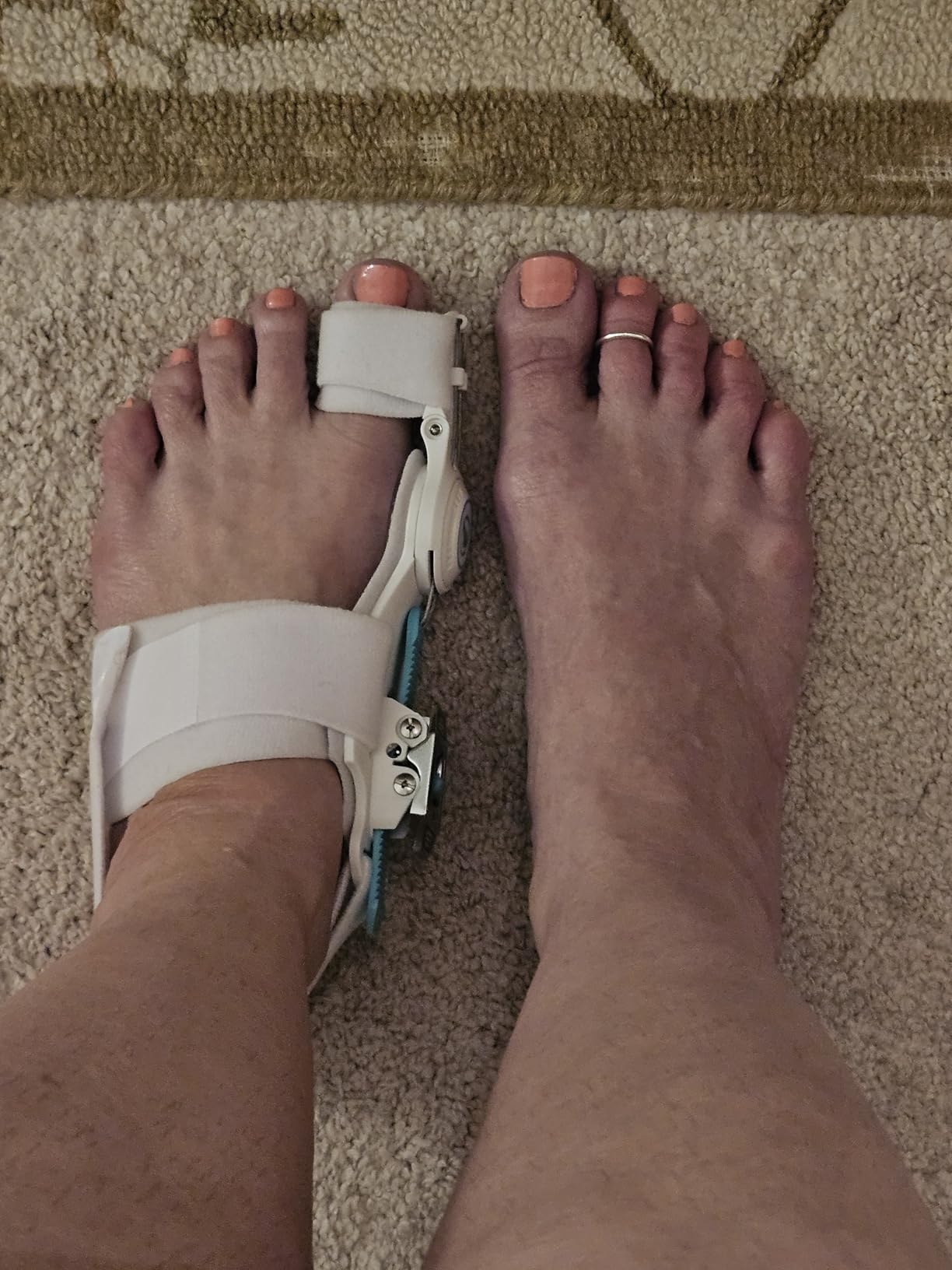 Kutain Upgraded Bunion Corrector for Women & Men, Orthopedic Bunions Correction with Non Slip Big Toe Separators, Adjustable Bunion Splint Suitable for Left/Right Feet Bunion Relief (1PCS) customer photo 2