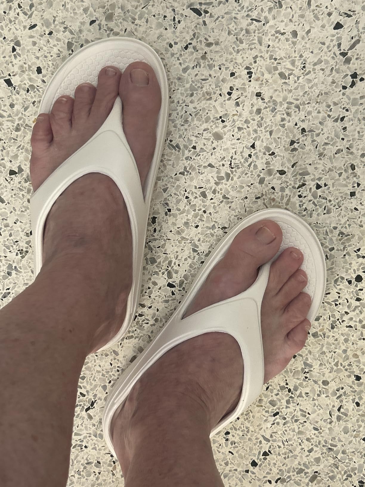 Orthopedic Sandals Flip Flops for Women Arch Support Pillow Soft Recovery Thong Sandals Spa Summer Beach Cloud Slides customer photo 2