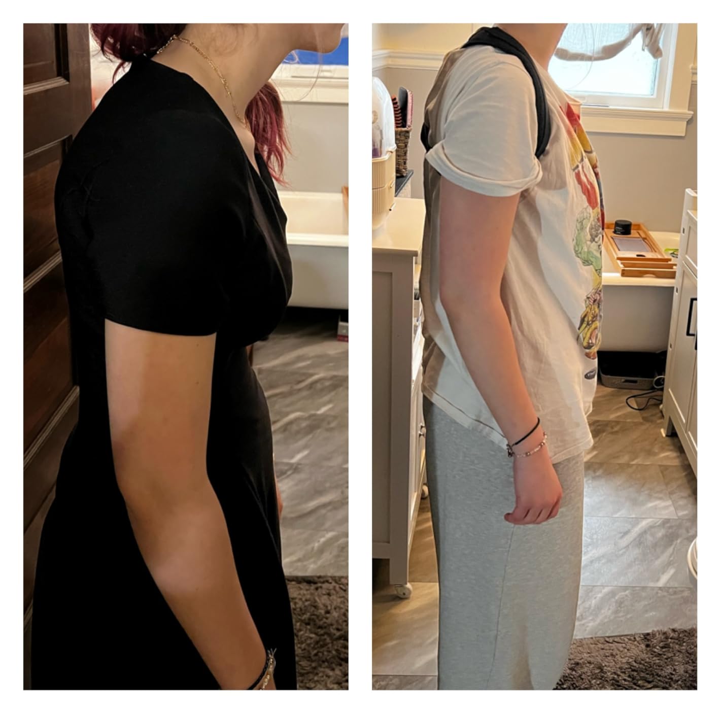 Posture Corrector for Women, Back Straightener for Men, Upper Back Support Brace, Adjustable Shoulder Corrector for Improving Back and Neck Posture Relief Pain customer photo 1