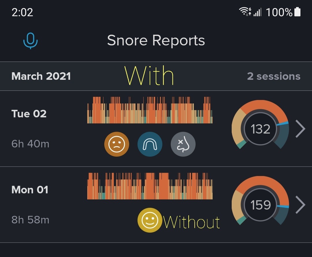 Tranquility PRO 2.0 Anti-Snoring Mouth Guard - Adjustable Mouthpiece - Night Time Mouthguard Stop Snore customer photo 2