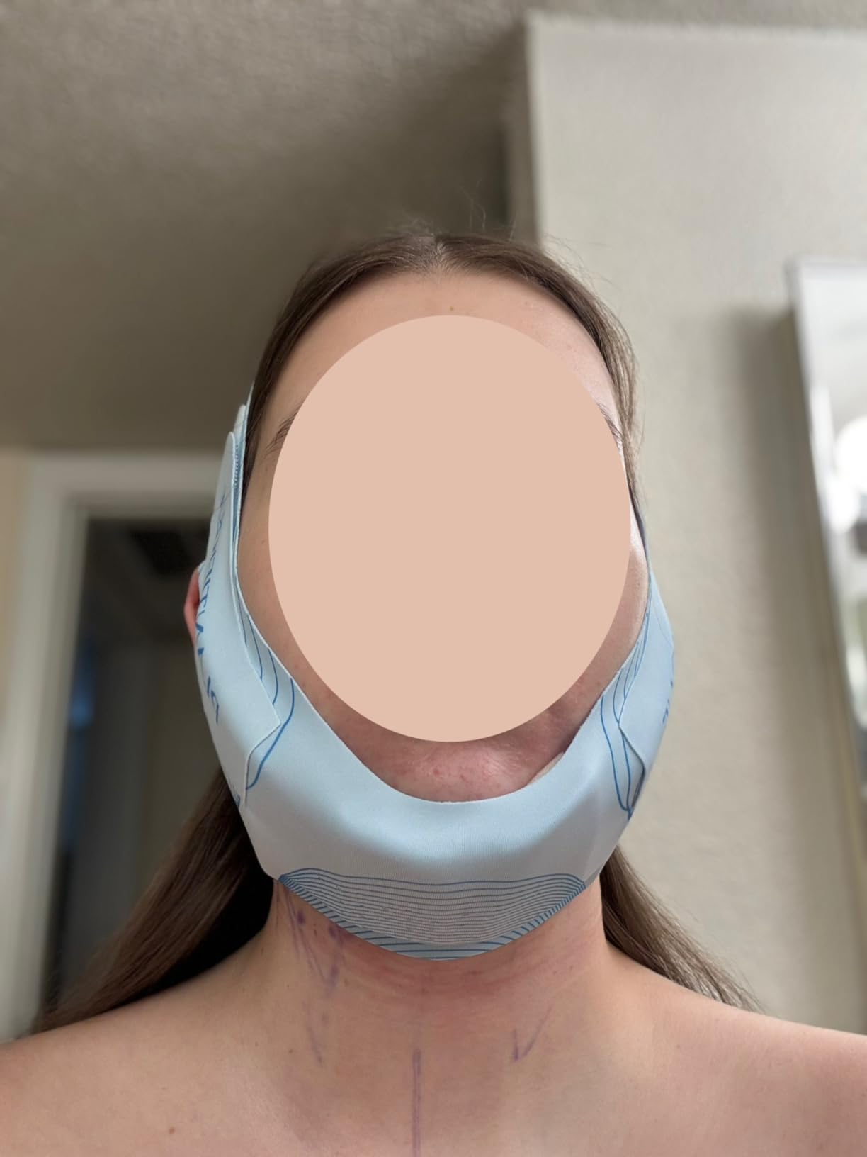 PLANTIFIQUE Chin Strap for Sleeping - Reusable & Adjustable | Chin Lifting Mask - Breathable Ice Silk Material - Double Chin Reducer & Jawline Shaper customer photo 2