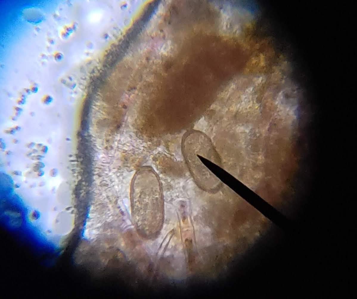 AmScope M150C 40X-1000X All-Metal Optical Glass Lenses Cordless LED Compound Biological Microscope All-Metal Construction Cordless Battery Powered customer photo 2