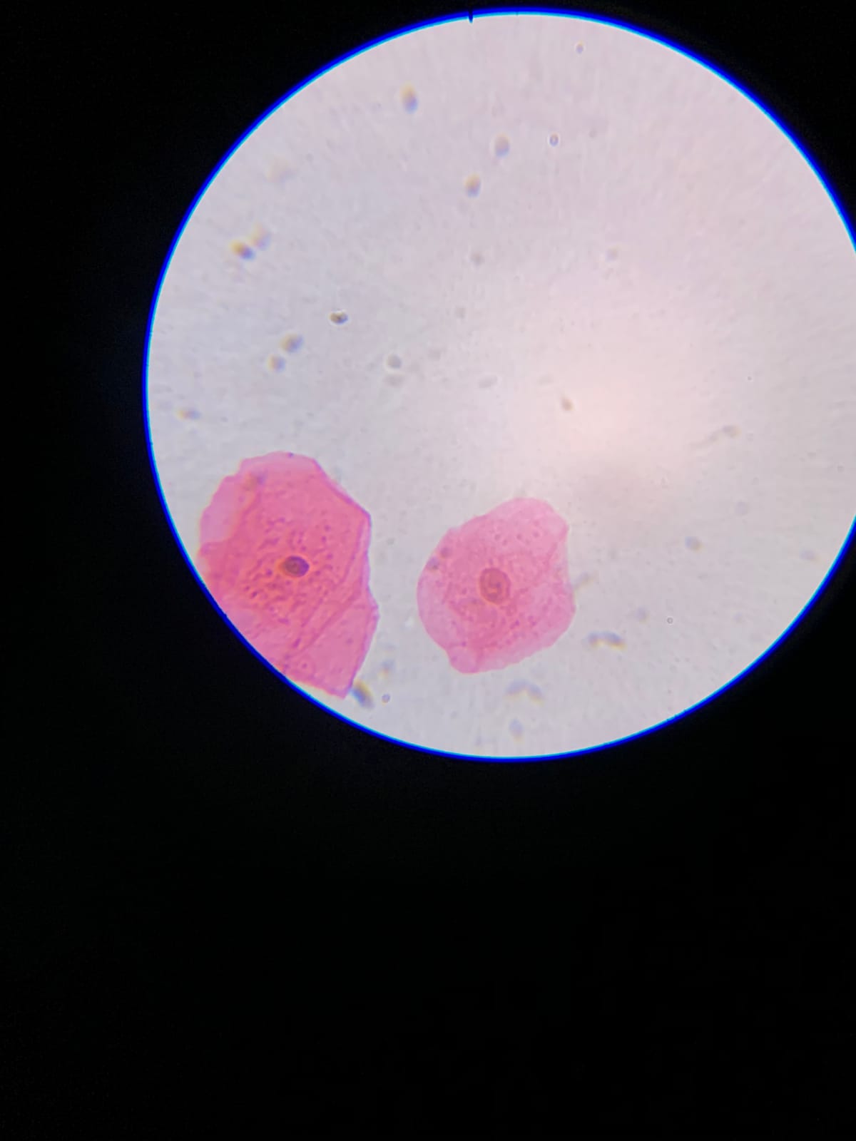 AmScope M162C-2L-PB10-WM Awarded 2018 Best Microscope Kit - 40X-1000X Magnification Range All-Metal Construction customer photo 1