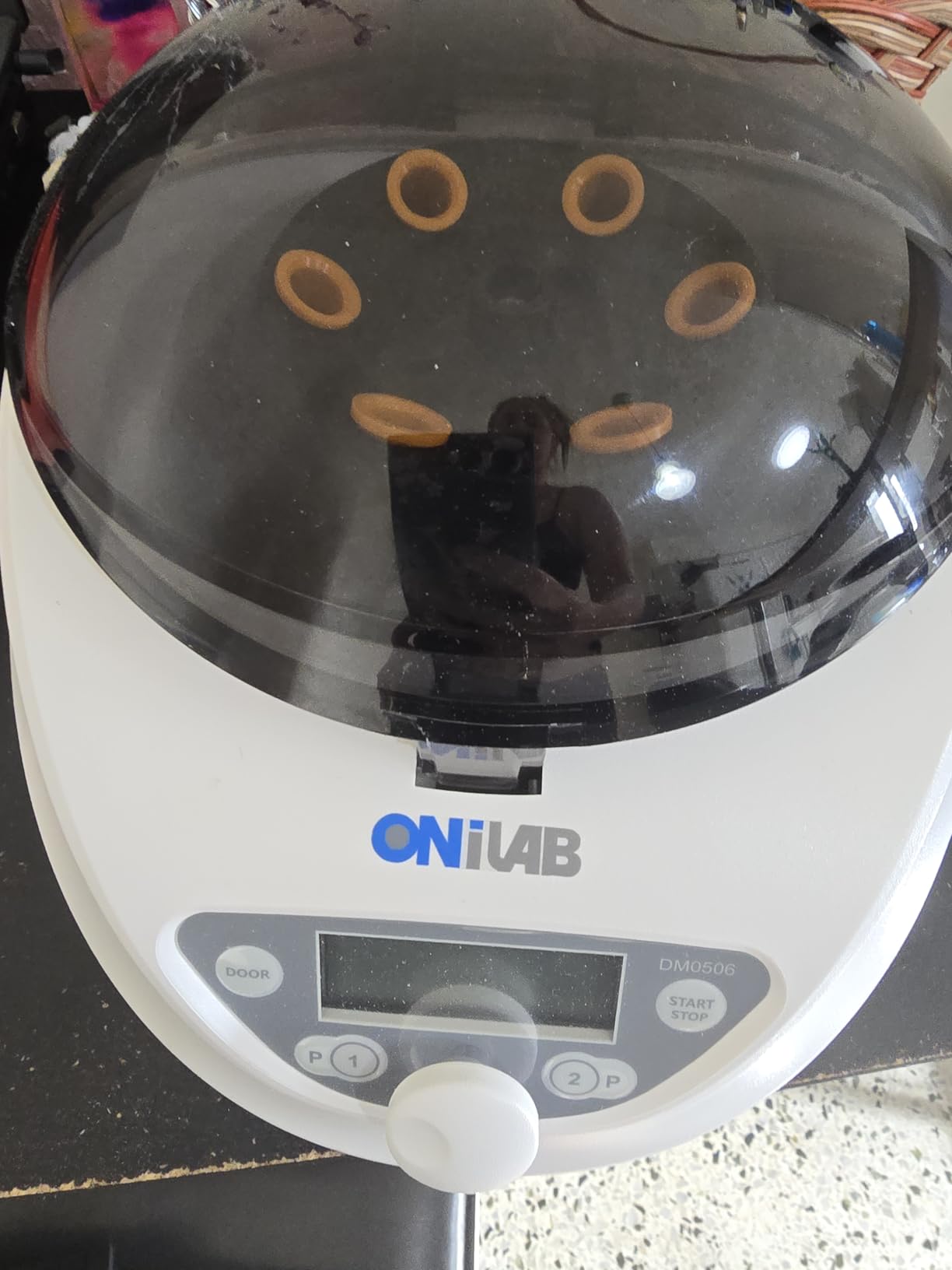 ONiLAB Lab PRP Benchtop Centrifuge 6x15mL/10mL/7mL/1.5-5ml, 300-5000rpm(Max. 2600xg RCF),LCD Digital Desktop Lab Centrifuge Timer 30sec-99min, Two Quick Start Programs customer photo 1